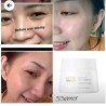 Atomy Absolute Spot-Out Cream